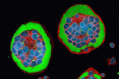 Flourescence image of rinderpest