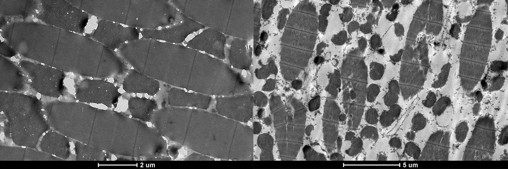 Deformed muscles seen in females with the edited Act4 gene showing large defects in the muscle fibres (left) alongside non-edited female muscles that have formed normally.
