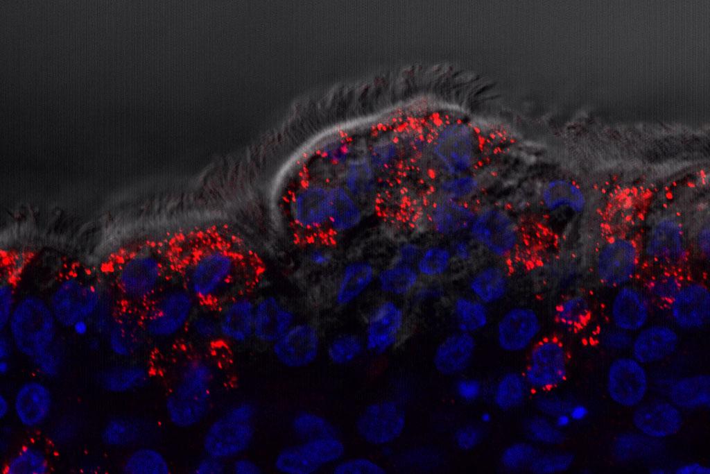 infectious bronchitis virus infecting cells